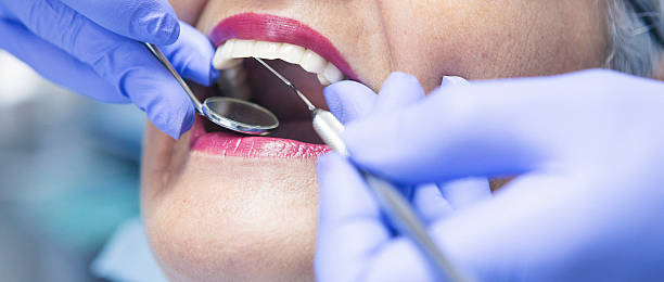 Best Emergency Root Canal Treatment in Bangor, PA